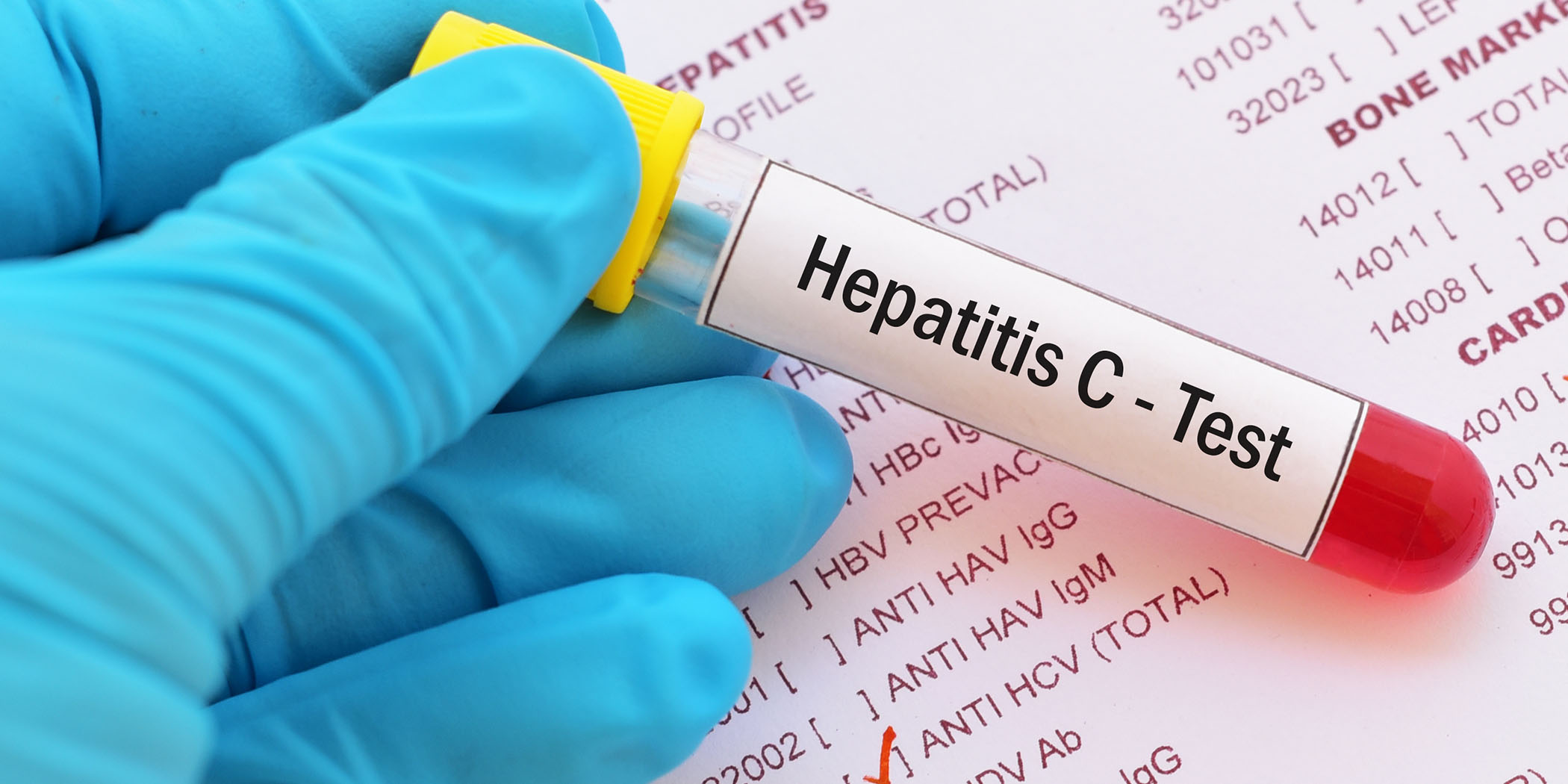 Understanding Hepatitis C and Other Common Health Conditions